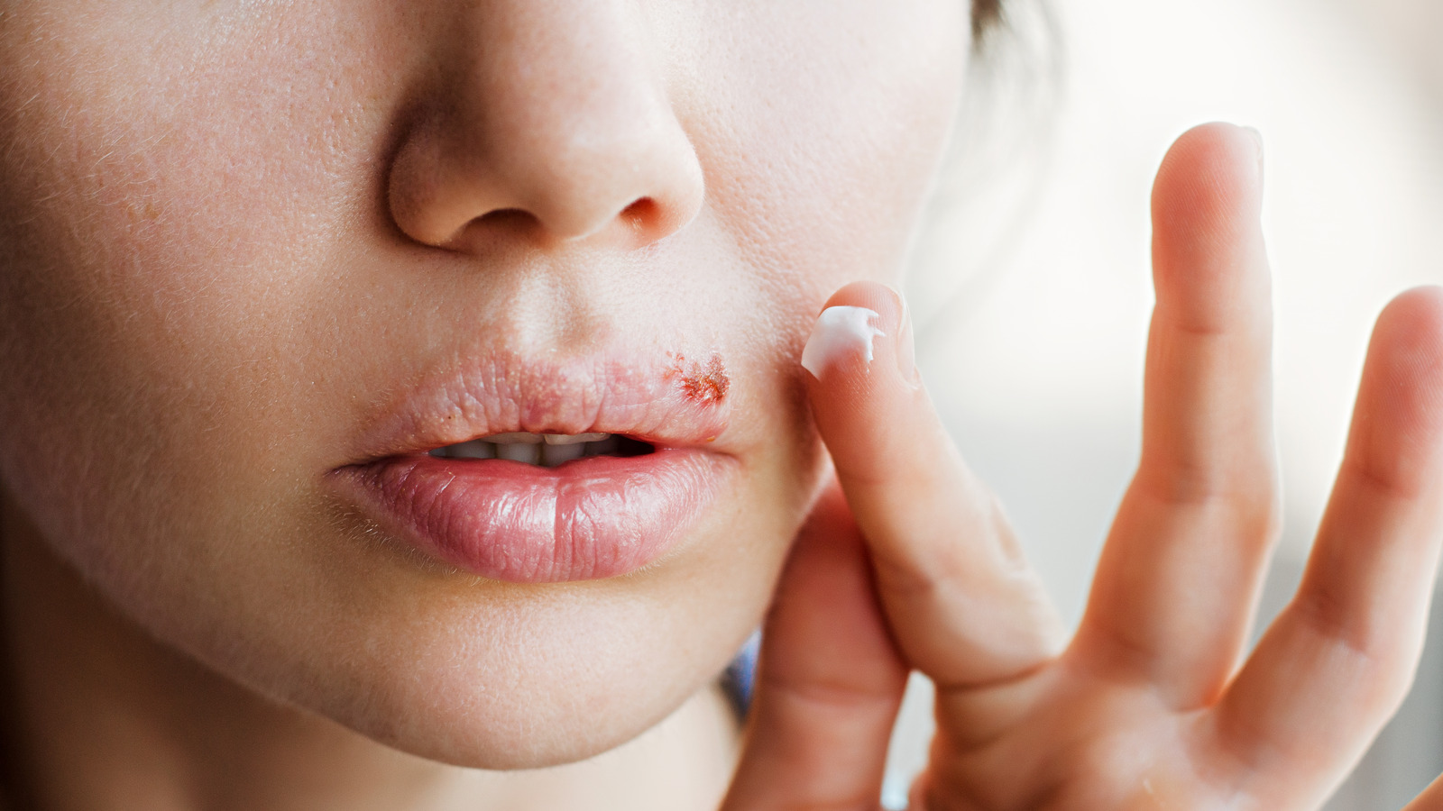 how-to-get-rid-of-a-cold-sore-overnight-fab-how