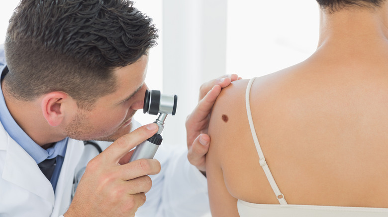 dermatologist checking out mole on a woman's back