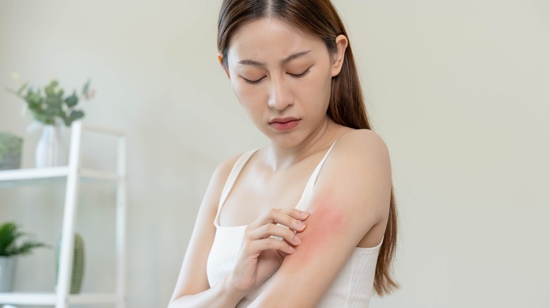 woman looking at a small rash on her arm