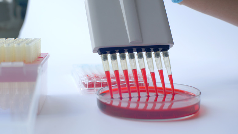 Blood sample test in laboratory 