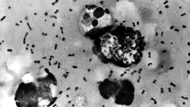 plague-causing Yersinia pestis bacteria 