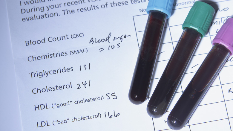 tubes of blood and cholesterol test report