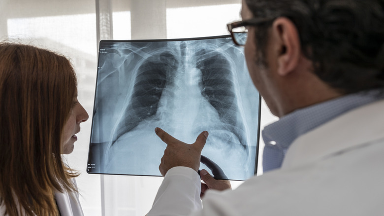 two medical professionals looking at chest x-ray