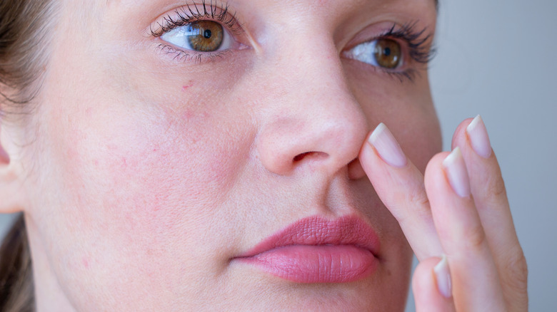 Dry Skin Explained Causes Symptoms And Treatments