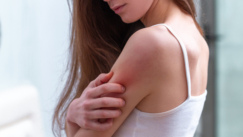 Woman itching arm