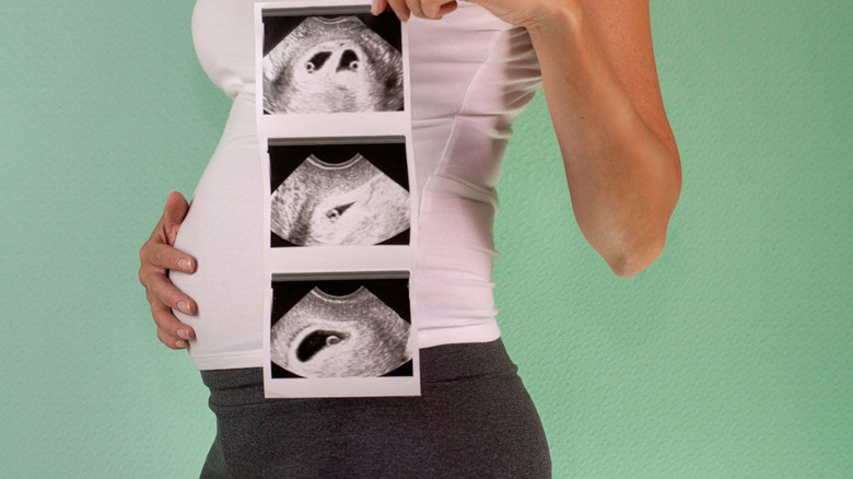 Pregnant woman holding ultrasound showing twins.