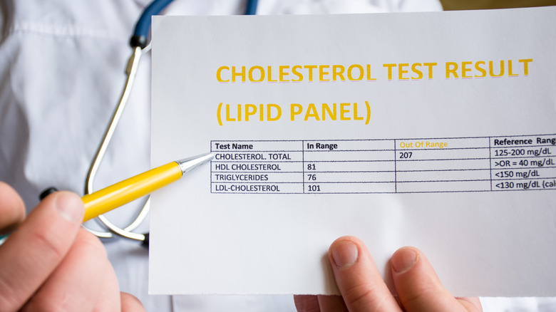 doctor's hand pointing to cholesterol numbers of patient