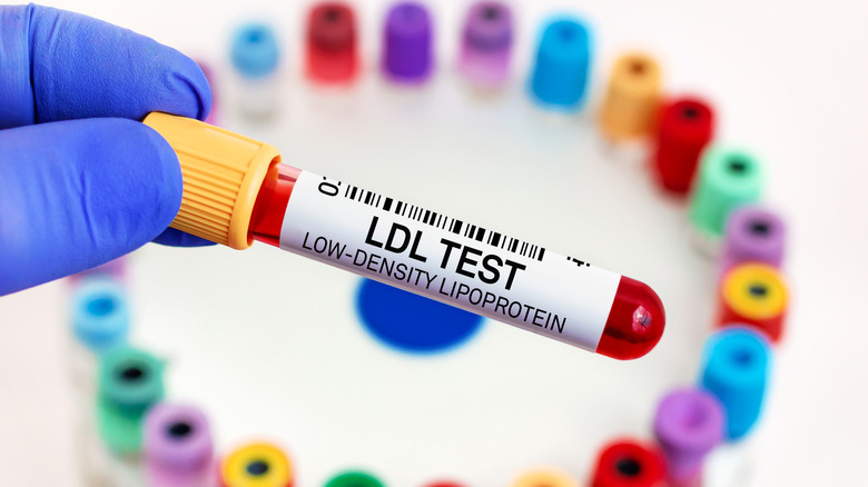 A hand holding a sample for ldl cholesterol test