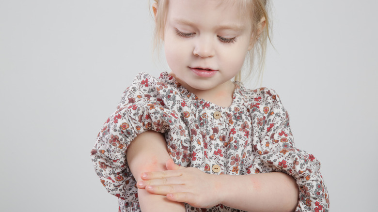 Toddler itching a red rash on their upper arm