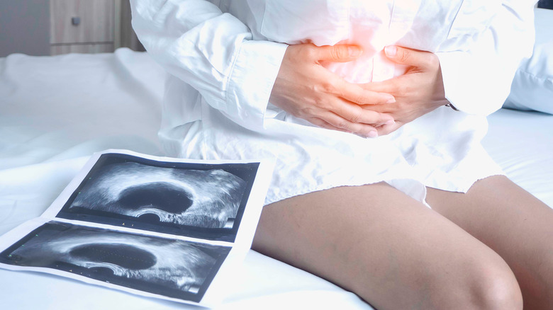 woman holding her abdomen with MRI images beside her