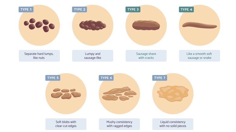 Bristol Stool Chart with seven types
