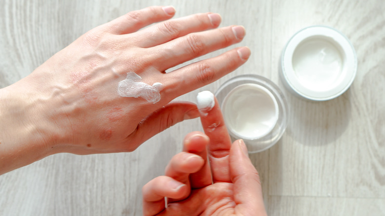 person applying ointment to hand