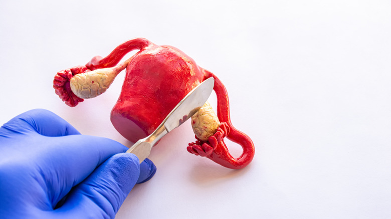 Surgeon holds scalpel to model ovaries
