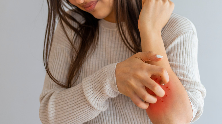 woman scratching an itch