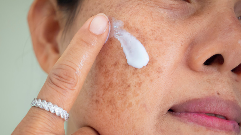 Woman with spots on her face applying a skincare product