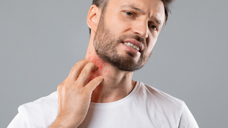 Man scratching rash on his neck