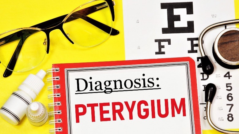 doctor's diagnosis clipboard reads 'pterygium'