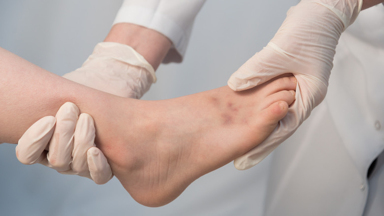 Doctor examining a child's injured ankle