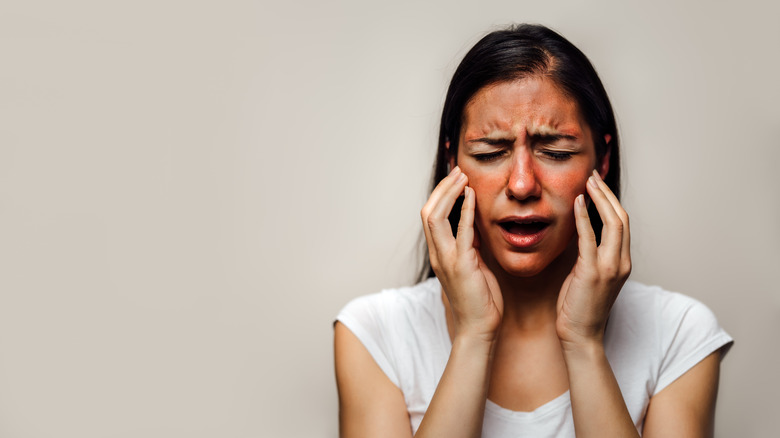 Woman with a painful red rash on her face