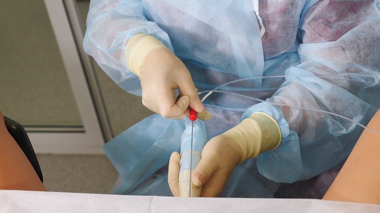 Doctor performing an in vitro fertilization procedure