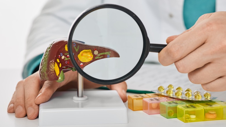 Liver cancer model