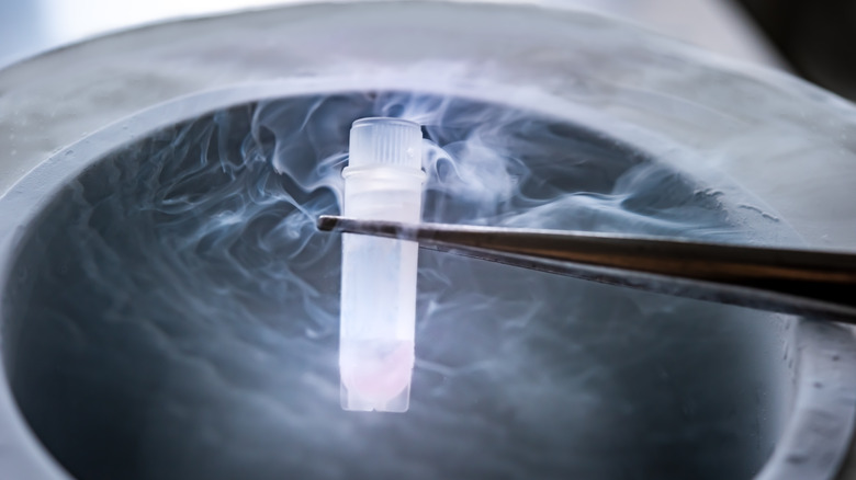 doctor putting sperm sample into liquid nitrogen for cryopreservation 