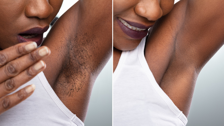 before and after of woman's armpit