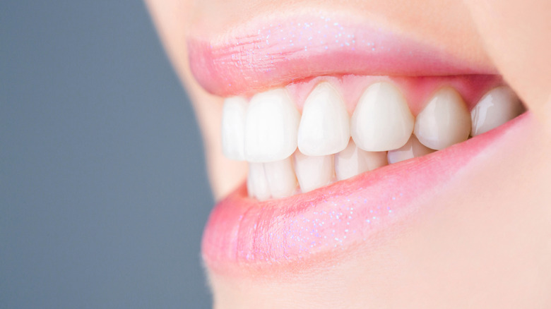 white clean teeth