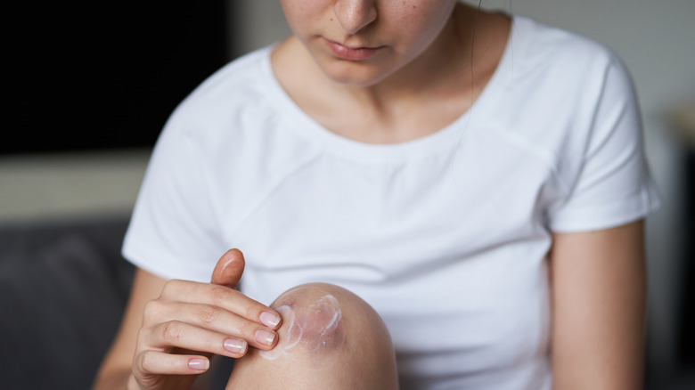 Woman putting cream on a bruise