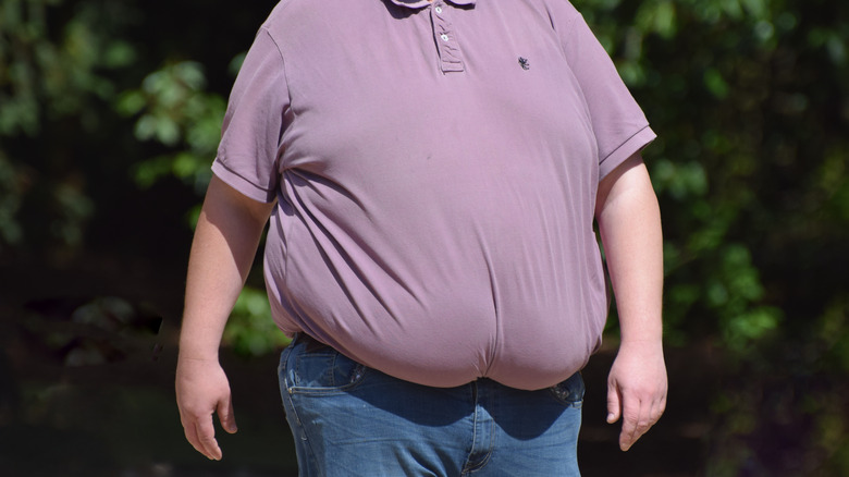 an obese man
