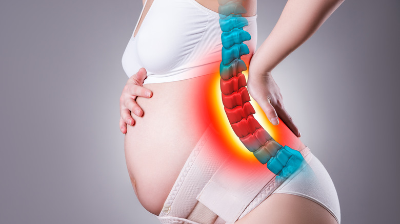 pregnant woman with sciatica