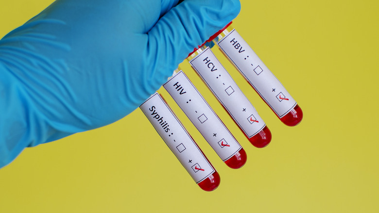 sti test vials on yellow background