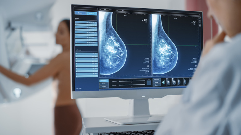doctor examining mammogram images