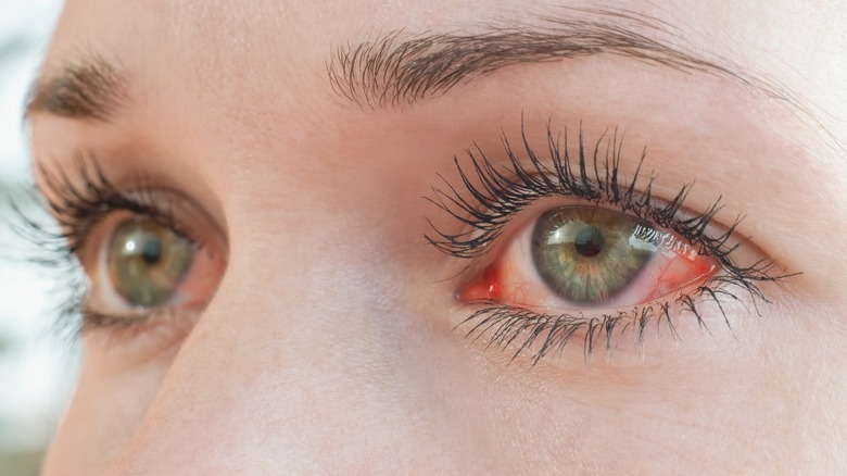 close up of woman's strained eyes