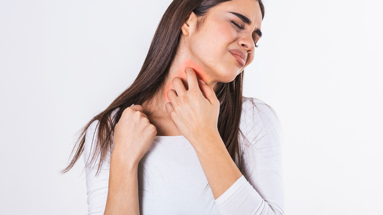 Woman scratching itchy neck