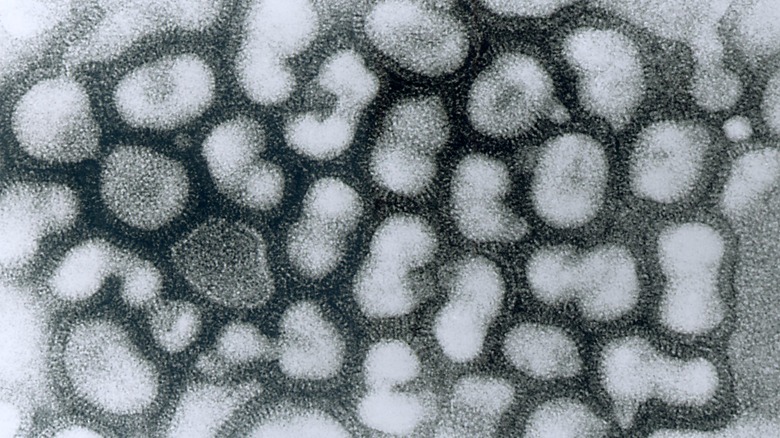 microscopic view of influenza A virus