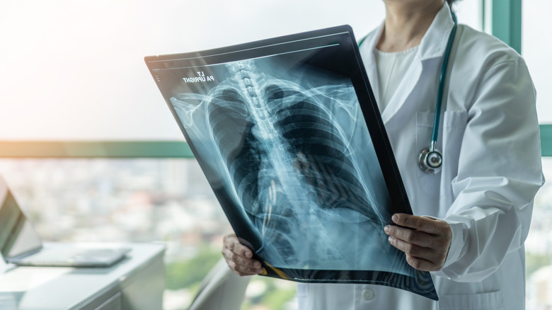 A doctor examines an X-ray looking for cancer