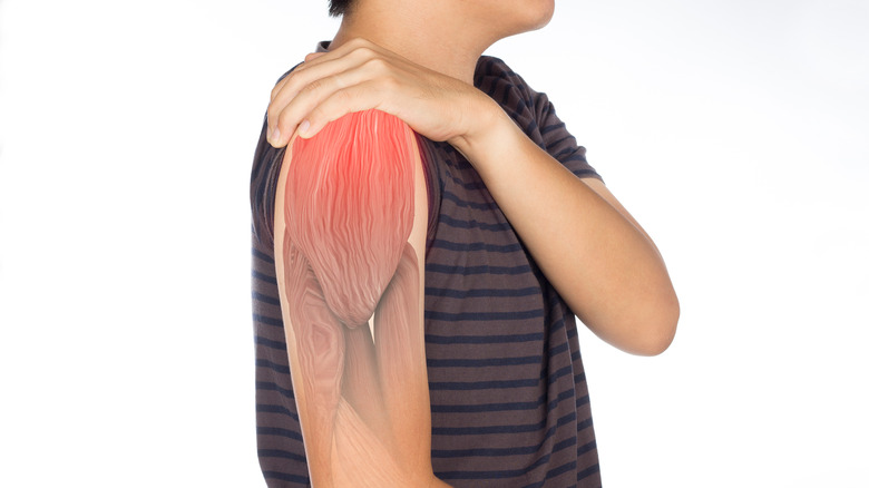 An illustration of the anatomy of the arm and shoulder 