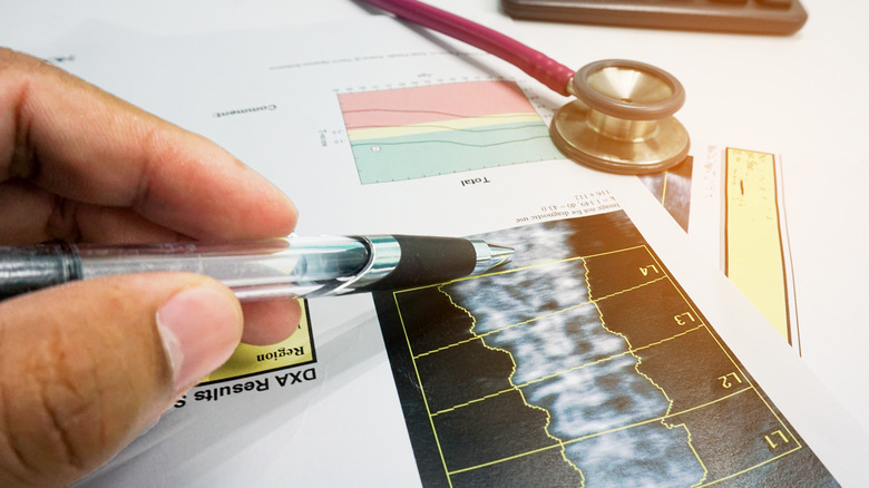 A doctor examining bone density