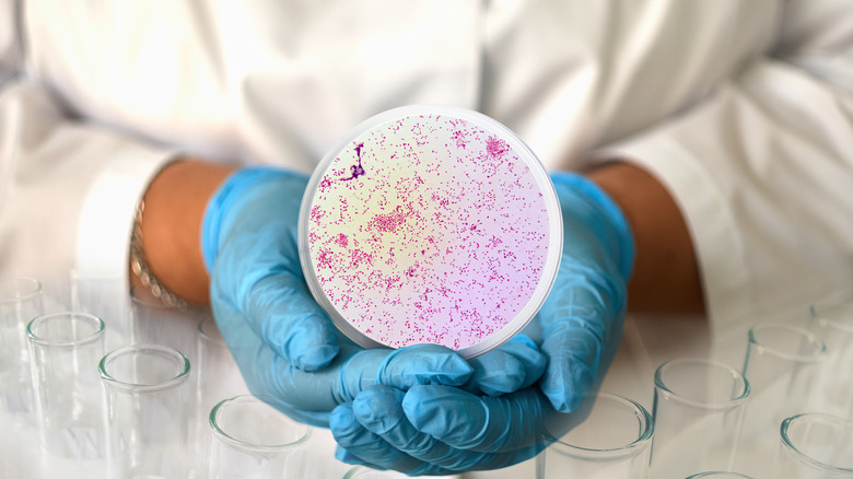 nurse holding container with bacteria