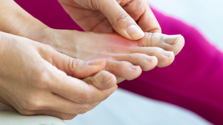 toe pain from gout