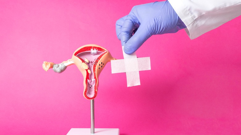 Ovarian cyst replica