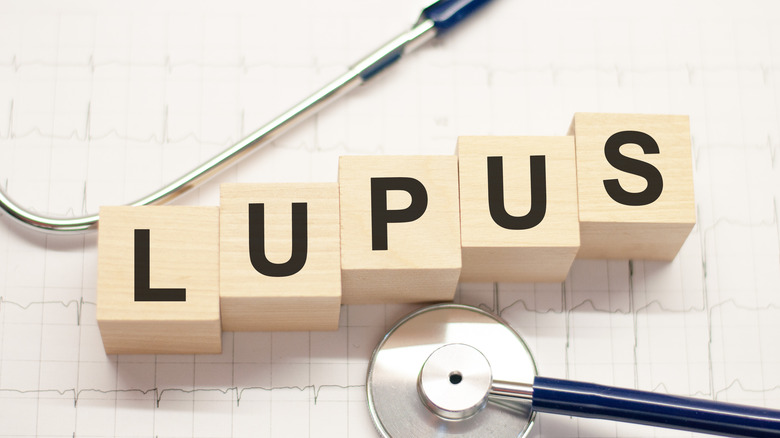 the word lupus spelled out in wooden blocks by a stethoscope on top of an ekg reading