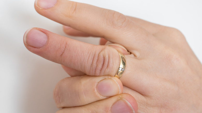 a person with a swollen ring finger