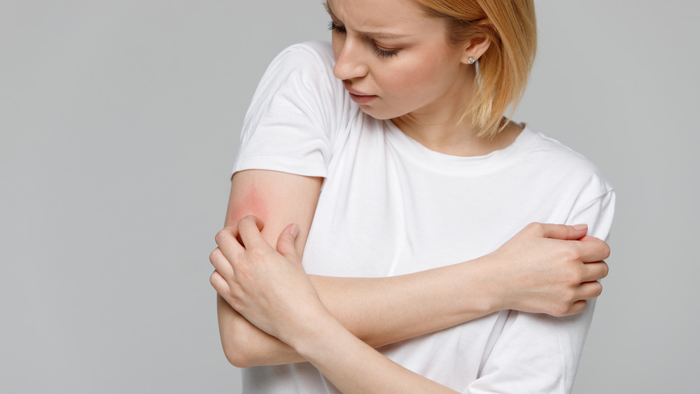 person wearing white shirt holding their arm, which is red with an allergic reaction