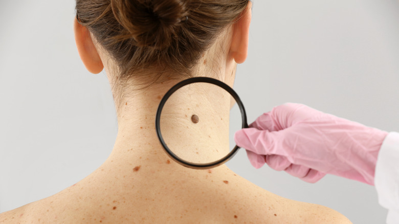 Woman with mole on neck