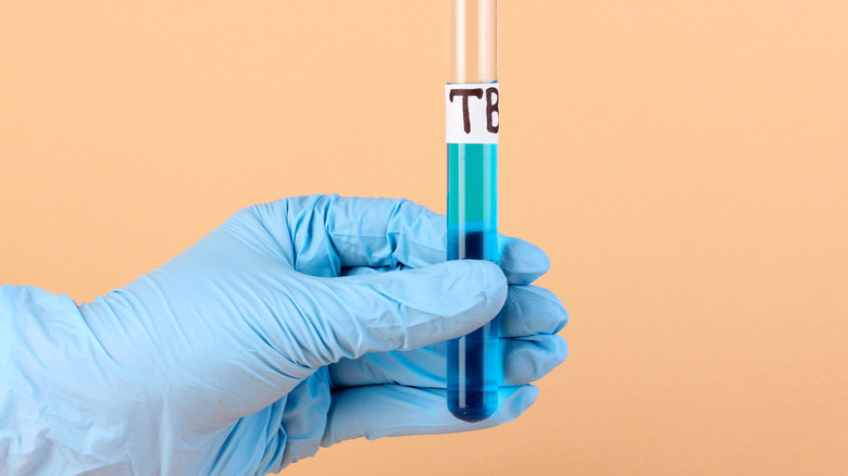 Test tube labeled Tuberculosis (TB) in hand on beige background