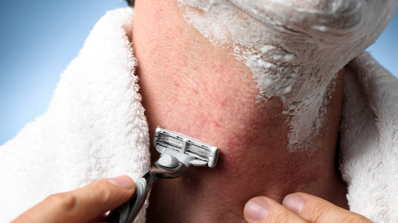 Close up of a man shaving his neck, which has razor burns on it