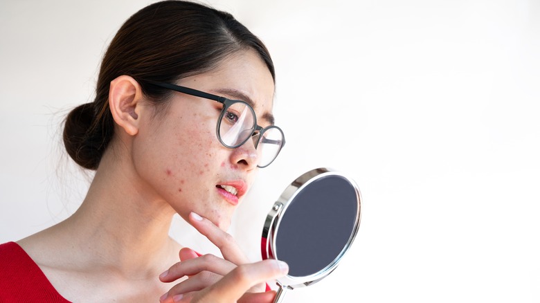 Woman with pimples looking in a hand mirror