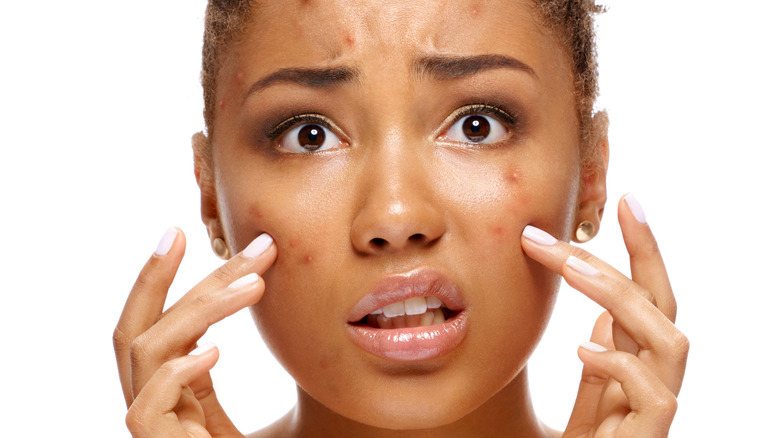 Woman looking at her pimples with a worried expression